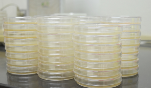 Ethanol Fermentation Contamination